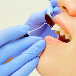 examining-teeth