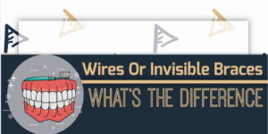 Wired Or Invisible Braces