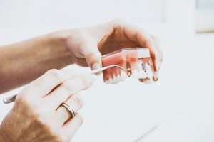 A dentist demonstrating an implant procedure on a mold