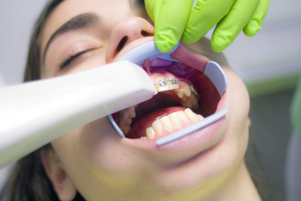 A dentist putting braces in for a patient