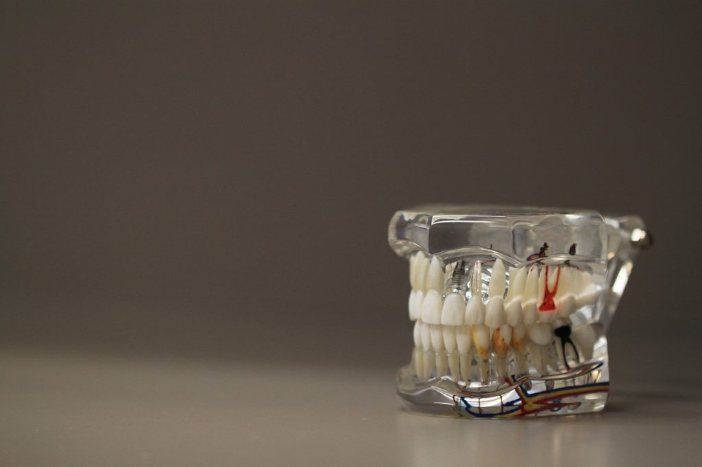 Glass model of human teeth and gums