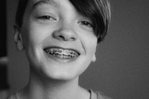 A child with braces smiles