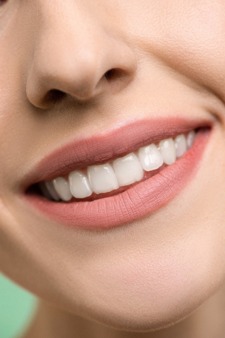 a girl smiling with aligned teeth 