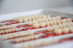 dental implants on a tray