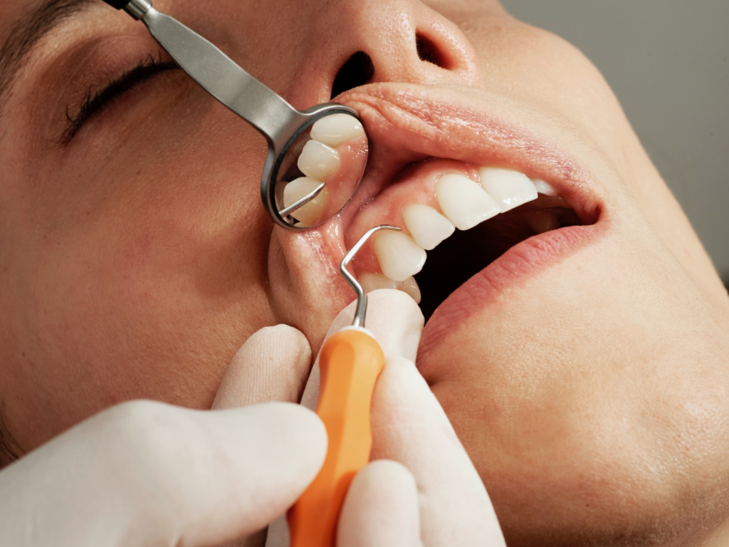 a woman getting a preventive dental checkup