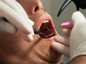 dentist performing an examination
