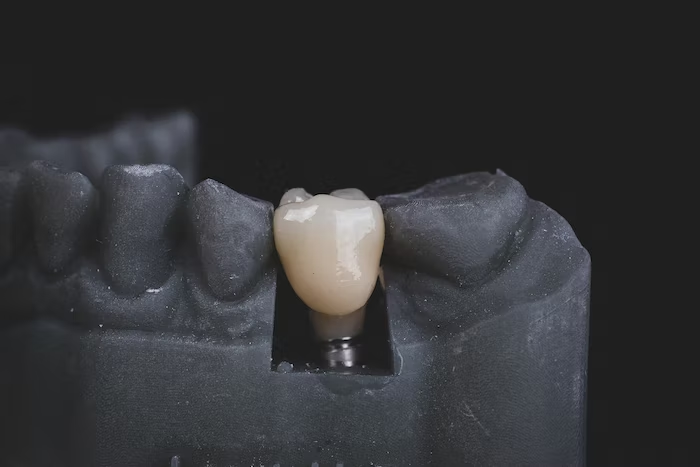 A model holding a dental implant
