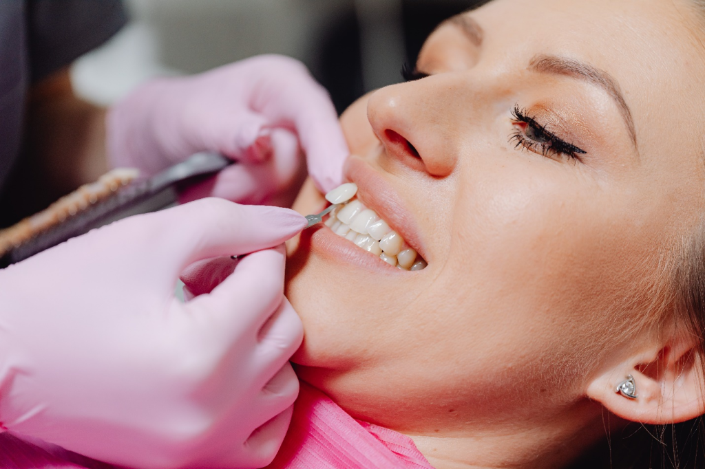 A dentist is applying dental veneers onto a woman’s front tooth