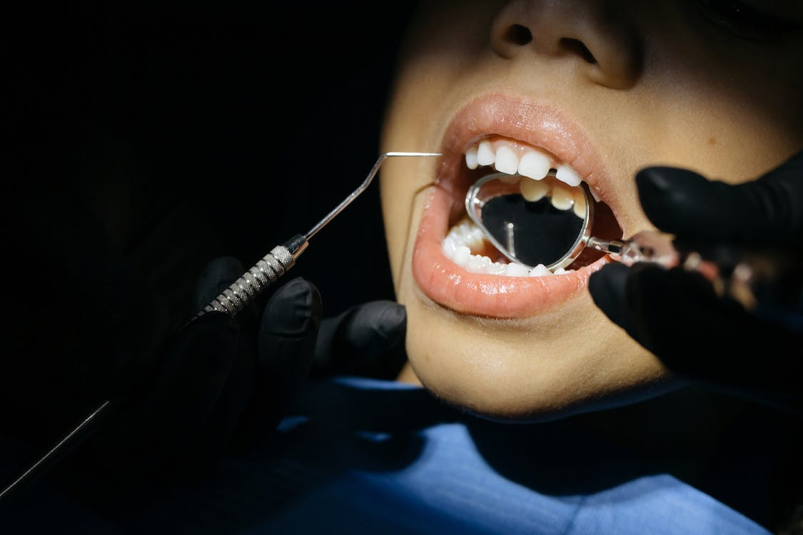 A closeup of a kid’s dental checkup