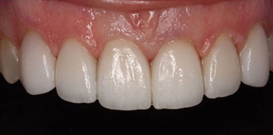An image showing a healthy smile by West Hills Smiles