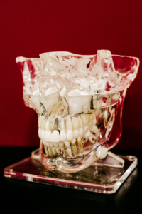 A white jaw model of a dental implant
